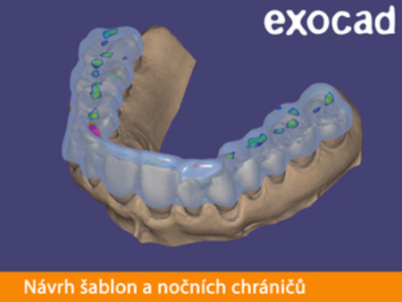 Exocad Bite Splint Module