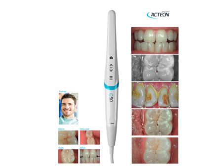 Intraorální kamera Acteon Satelec C50-4 v 1 Full HD kamera