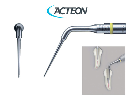 Acteon Satelec ET20 - Odstranění kořenových výplní a zalomených nástrojů