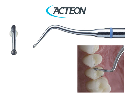 Acteon Satelec EX2 - Minimálně invazivní preparace. Poloviční kulička na meziální preparaci bez poškození sousedního zubu - bez krvácení