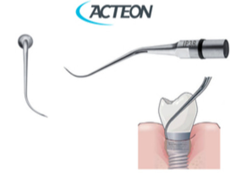 Acteon Satelec IP3R - Speciální titanová koncovka na šetrné ošetření implantátů a abutmentů