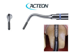 Acteon Satelec PM1 - Minimálně invazivní preparace preparace na zaoblený schůdek (hrubší) bez krvácení
