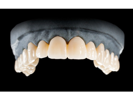 DD Nacera® Pearl Natural, multilayer zirkon, translucentní, D3, 16 mm