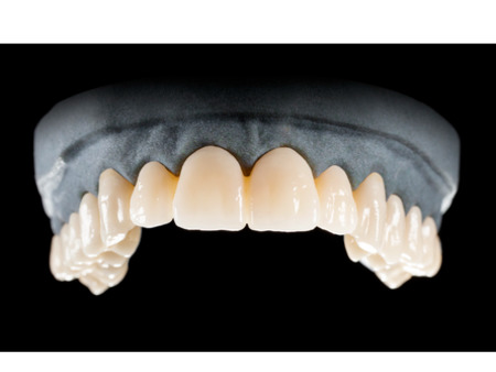DD Nacera® Pearl Natural, multilayer zirkon, translucentní, 0M2, 20 mm
