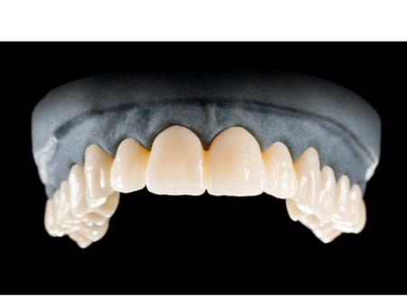 DD Nacera® Pearl Natural, multilayer zirkon, translucentní, A2, 25 mm