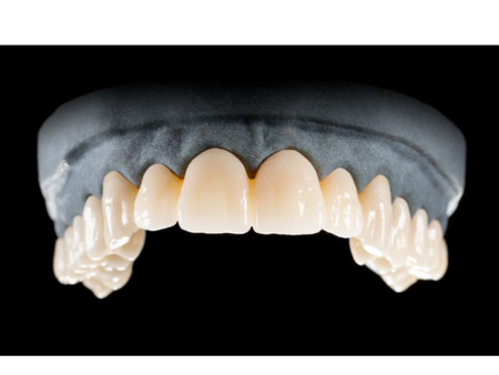 DD Nacera® Pearl Natural, multilayer zirkon, translucentní, B1, 25 mm