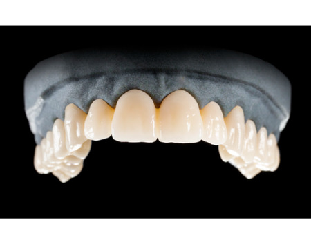 DD Nacera® Pearl Natural, multilayer zirkon, translucentní, B2, 20 mm