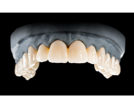 DD Nacera® Pearl Natural, multilayer zirkon, translucentní, B2, 25 mm
