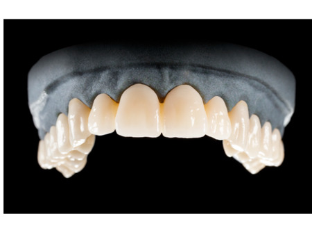 DD Nacera® Pearl Natural, multilayer zirkon, translucentní, B3, 20 mm
