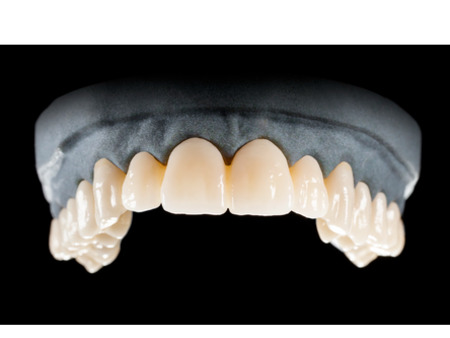 DD Nacera® Pearl Natural, multilayer zirkon, translucentní, B3, 25 mm