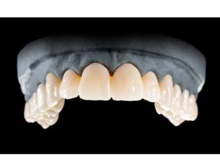 DD Nacera® Pearl Natural, multilayer zirkon, translucentní, B4, 16 mm