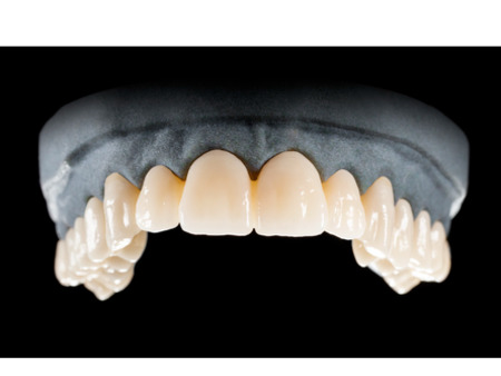 DD Nacera® Pearl Natural, multilayer zirkon, translucentní, B4, 25 mm