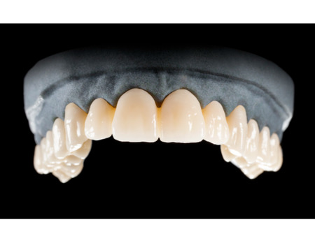 DD Nacera® Pearl Natural, multilayer zirkon, translucentní, C1, 20 mm
