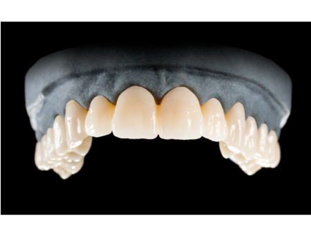 DD Nacera® Pearl Natural, multilayer zirkon, translucentní, C3, 16 mm