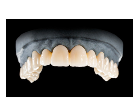 DD Nacera® Pearl Natural, multilayer zirkon, translucentní, C3, 25 mm