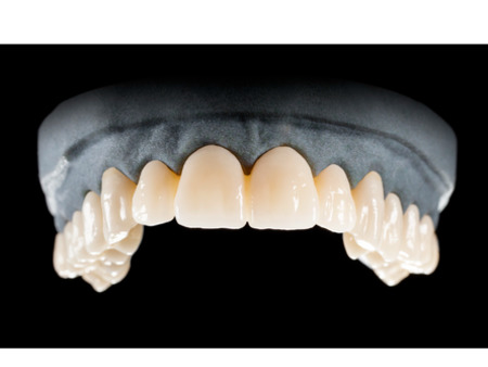 DD Nacera® Pearl Natural, multilayer zirkon, translucentní, D2, 20 mm