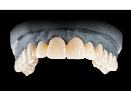 DD Nacera® Pearl Natural, multilayer zirkon, translucentní, D2, 25 mm