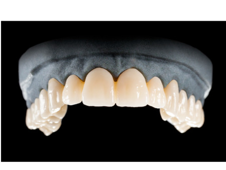 DD Nacera® Pearl Natural, multilayer zirkon, translucentní, D4, 20 mm