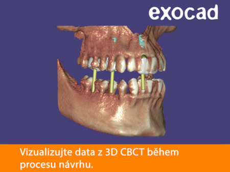 Exocad DICOM Viewer