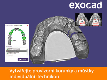 Exocad Exoscan