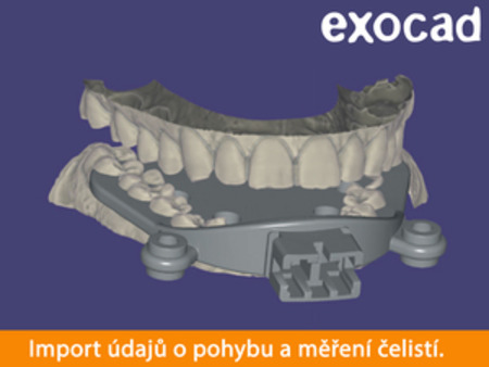 Exocad Jaw Motion Import