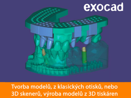 Exocad Model Creator