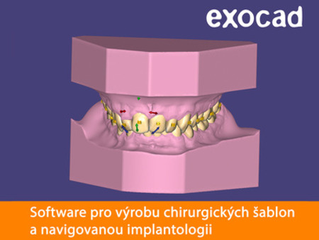 Exocad Ortho