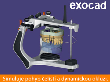 Exocad Virtual Articulator