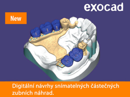 Exocad PartialCAD