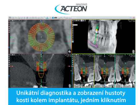 X-Mind Trium low dose 3D PAN