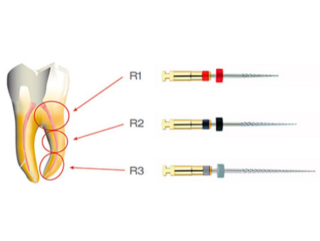 MicroMega R-ENDO R1-R3 SADA