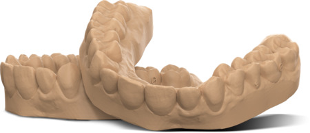 SprintRay dental Model Dune, 3kg