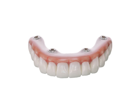 SprintRay OnX Tough 2 A1 500g