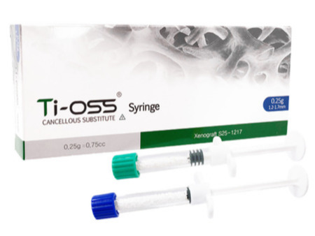 Ti-oss® Syringe  bovinní granulát 0.25g / 0.6cc(ml) objem 0.6 cm3, velikost zrna 0.5-1.2mm S25-0512