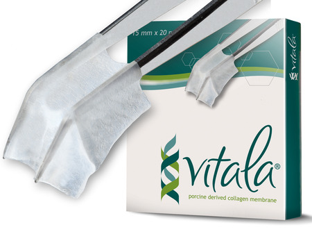 Vitala® 13 mm x 25 mm extra tenká Porcine Pericardium Collagen Membrane 