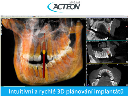 X-Mind PRIME 3D PAN FOV 12x10