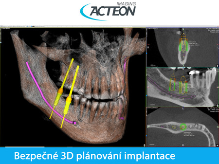 X-Mind PRIME wall 3D PAN FOV 12x10