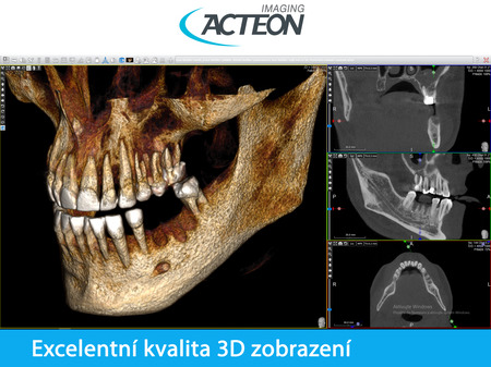 X-Mind PRIME 3D PAN CBCT