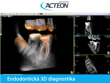 X-Mind PRIME wall 3D PAN CBCT