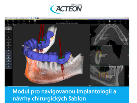 X-Mind Trium 3D PAN